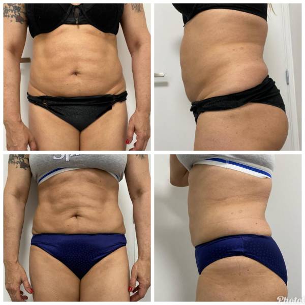 Votre cure minceur personnalisée à l'insitut Joali à Roanne