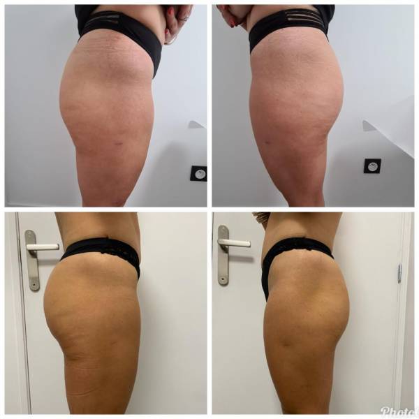 cure minceur à roanne près du coteau