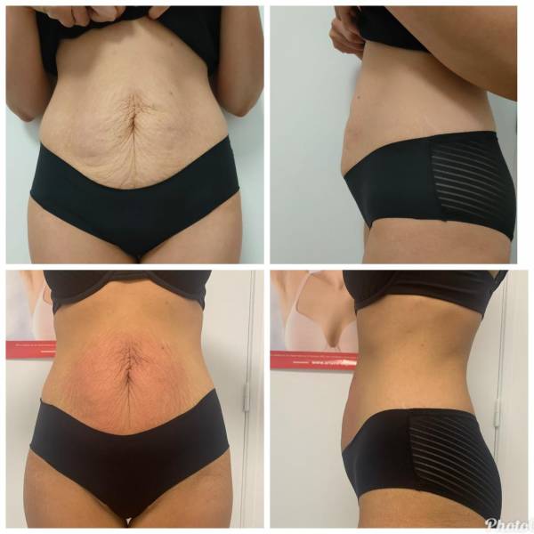 Votre cure minceur personnalisée à l'insitut Joali à Roanne