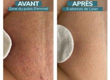 Notre zone d'activité pour ce service Tarif pose de vernis semi-permanent à Roanne 42300 près de Mably dans la Loire