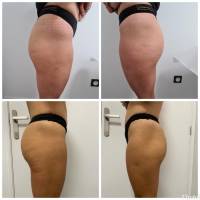 Nos prestations sur le secteur de Charlieu 42190 près de Pouilly-sous-Charlieu dans la Loire